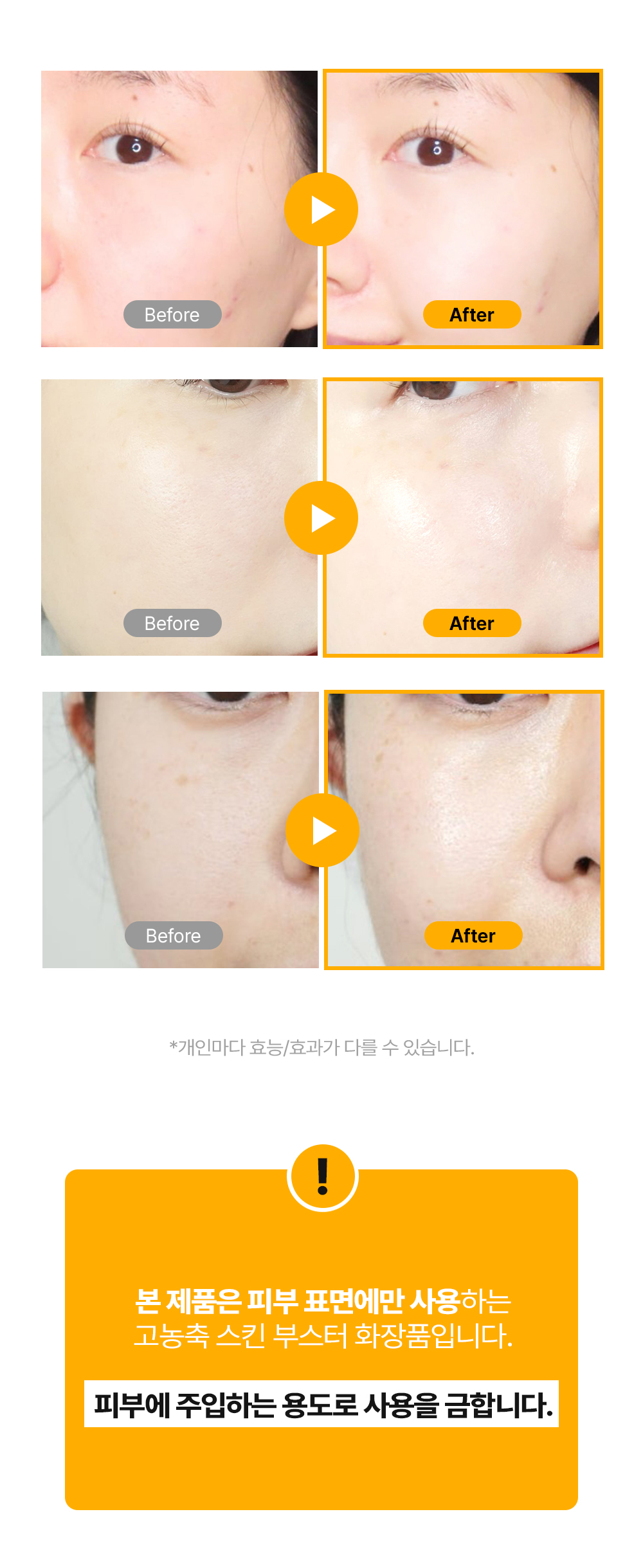Brightening_Toning_Skinbooster_starter_03.jpg