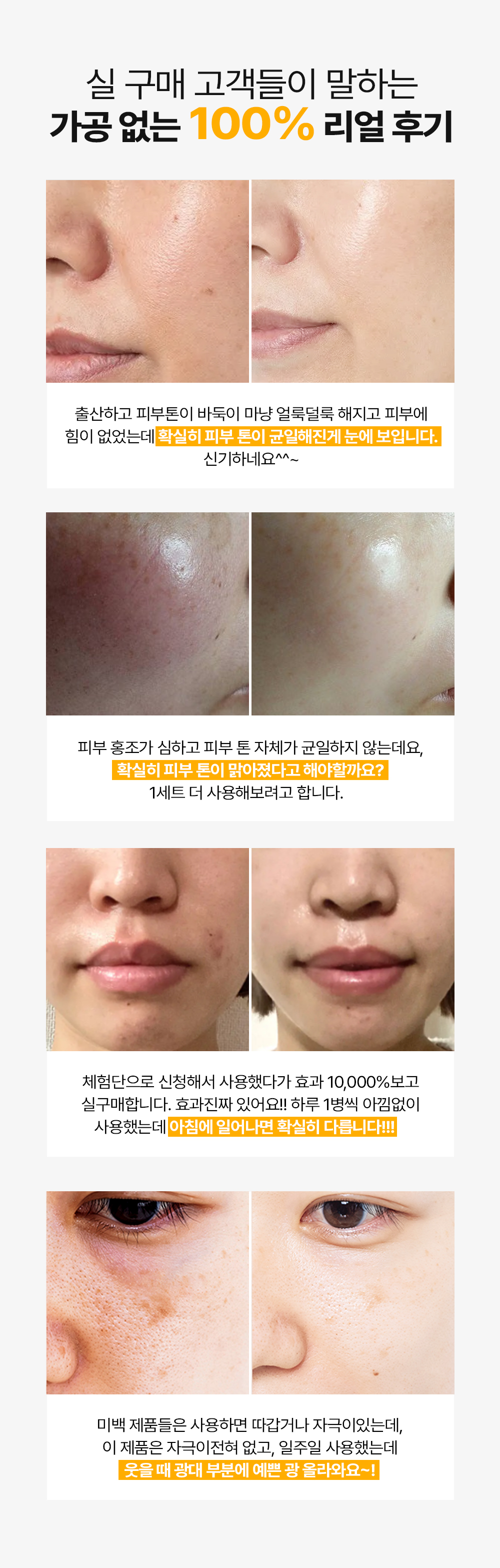 Brightening_Toning_Skinbooster_starter_05.jpg